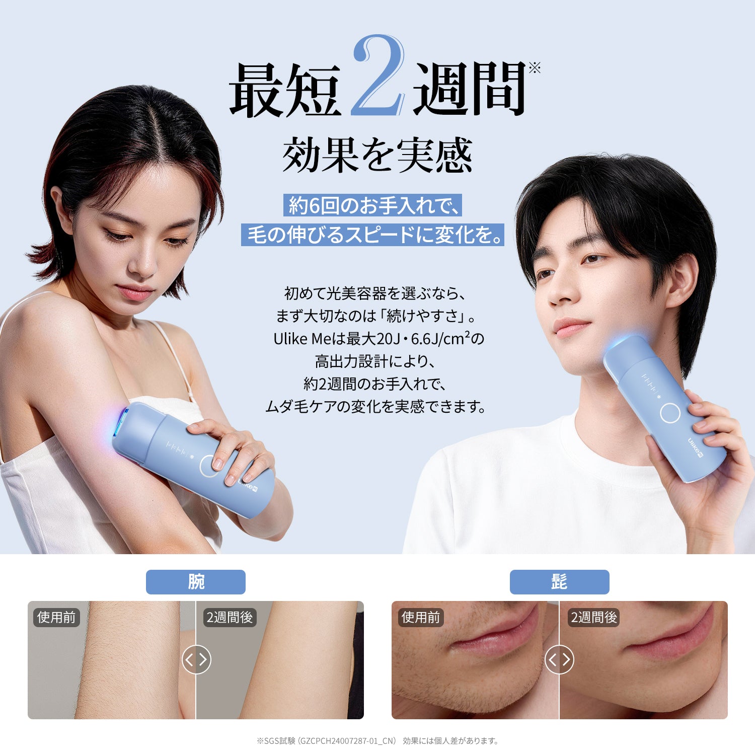 公式】Ulike Me IPL光美容器｜痛みレスな冷感サファイアで、輝く美肌へ