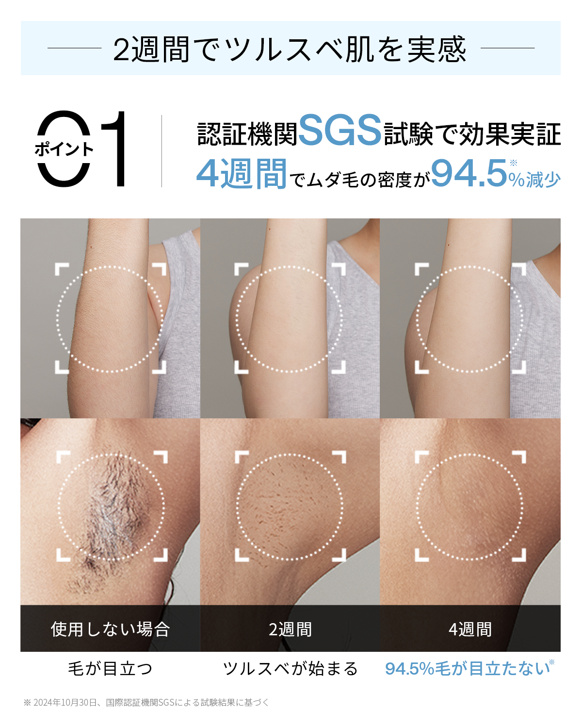 Ulike AirPro S IPL光美容器