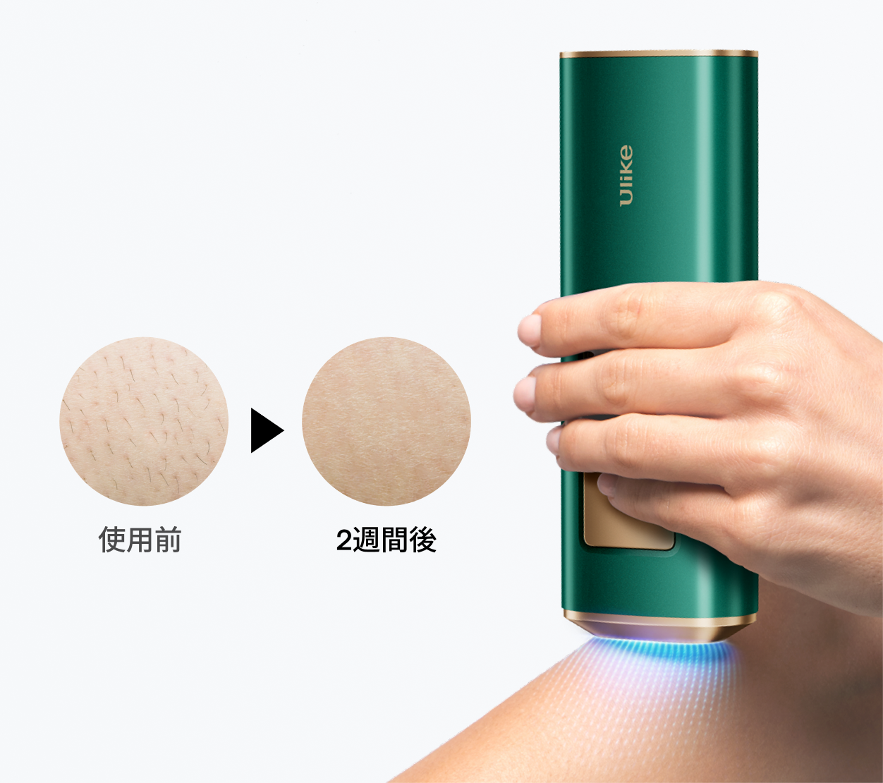 UIiKe脱毛器 UI04 UI04 Ulike Air 新品未使用Ulike UIiKe脱毛器UI04