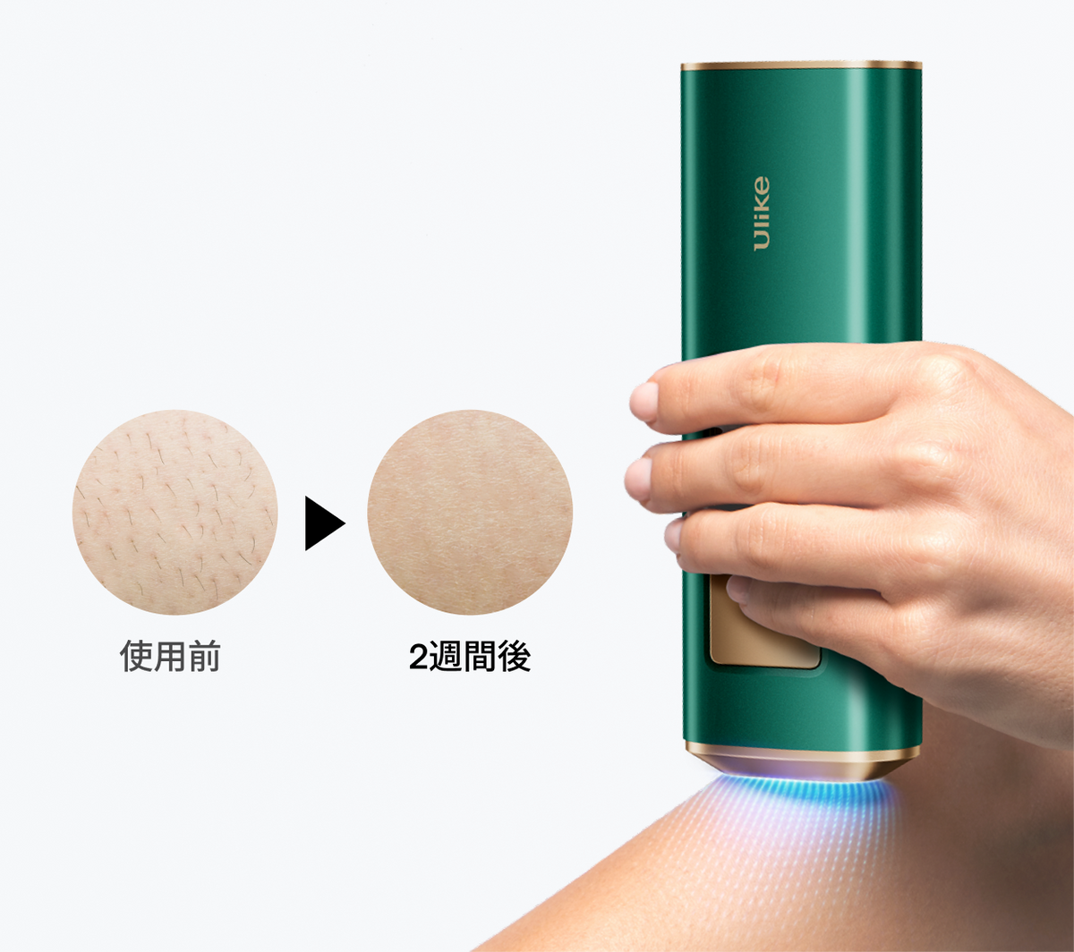 公式】Ulike AirPro S IPL光美容器|脱毛器・家庭用脱毛器・メンズ脱毛 公式】Ulike AirPro S IPL光美容器|脱毛器・家庭用脱毛器・メンズ脱毛