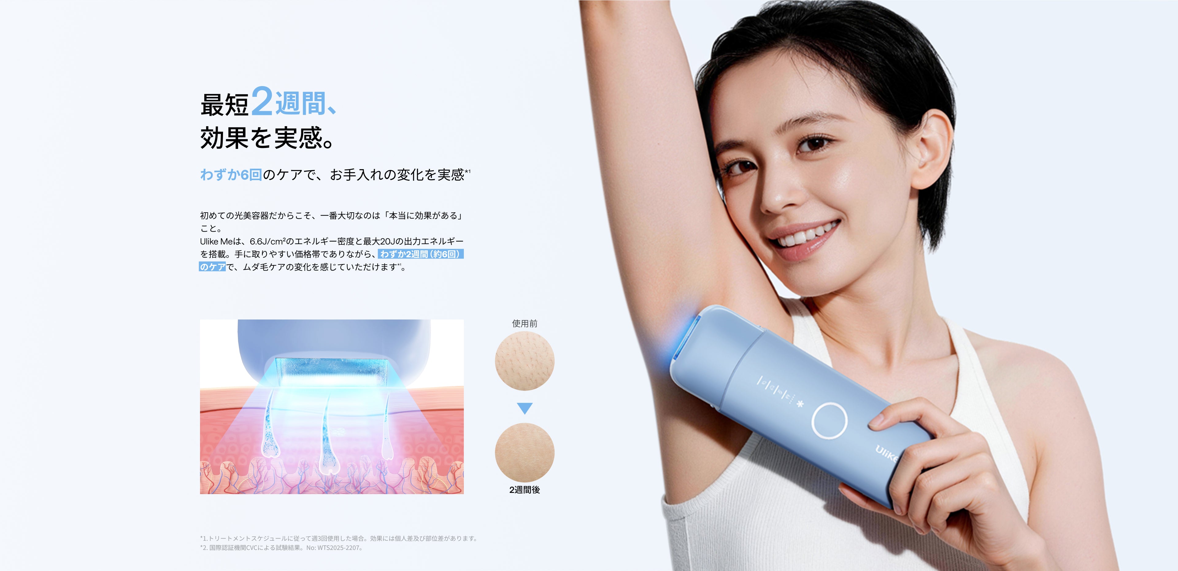 公式】Ulike Me IPL光美容器｜痛みレスな冷感サファイアで、輝く美肌へ