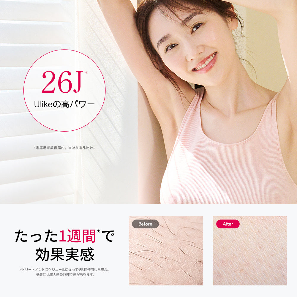 Ulike Air 10 Pro IPL光美容器