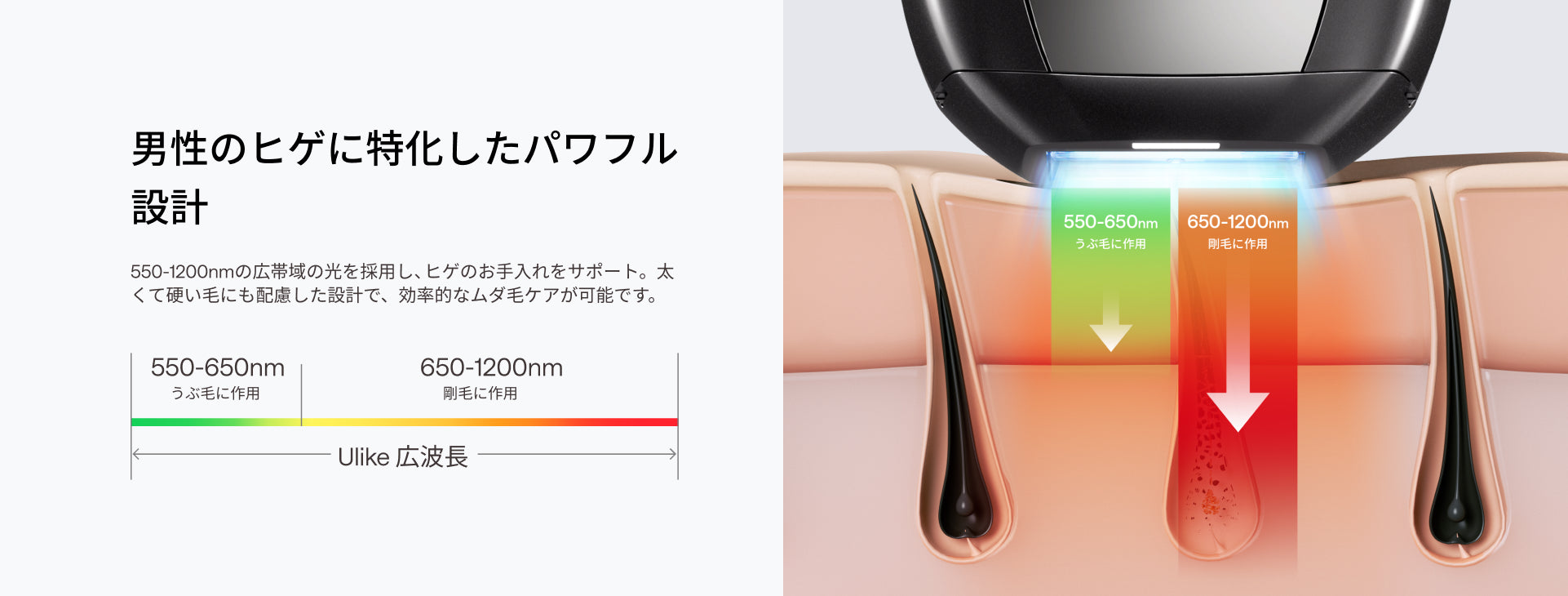 Ulike X Max IPL光美容器 アタッチメントキット｜毎朝の髭剃りにサヨナラ｜脱毛器・家庭用脱毛器・メンズ脱毛器・髭脱毛器・自宅脱毛器・光脱毛器・ipl光脱毛器・光美容器
