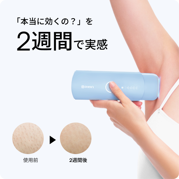 公式】Ulike Me IPL光美容器|痛みレスな冷感サファイアで、輝く美肌へ 公式】Ulike Me IPL光美容器|痛みレスな冷感サファイアで、輝く美肌へ