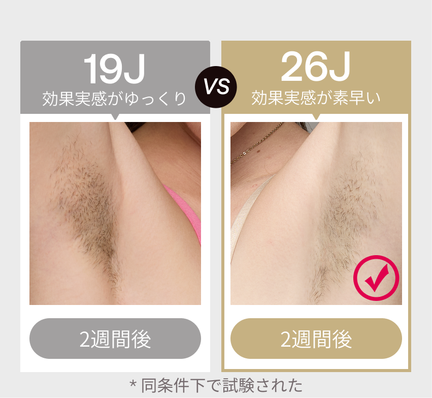 公式】Ulike(ユーライク)脱毛器・ 光美容器のサファイア冷感技術 公式】Ulike(ユーライク)脱毛器・ 光美容器のサファイア冷感技術